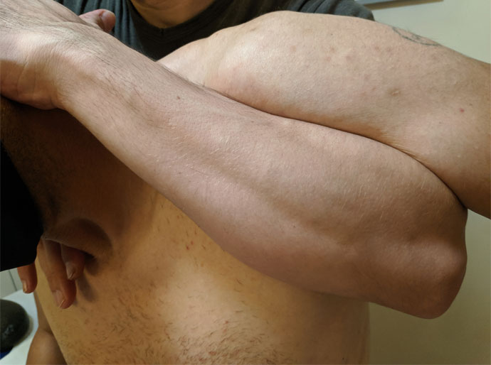 masaje osteopático en Badajoz colocando un hombro