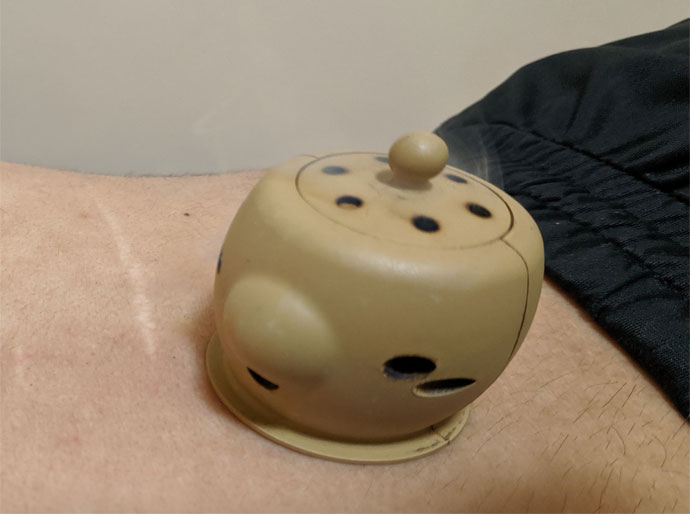 masaje con moxibustión en Badajoz